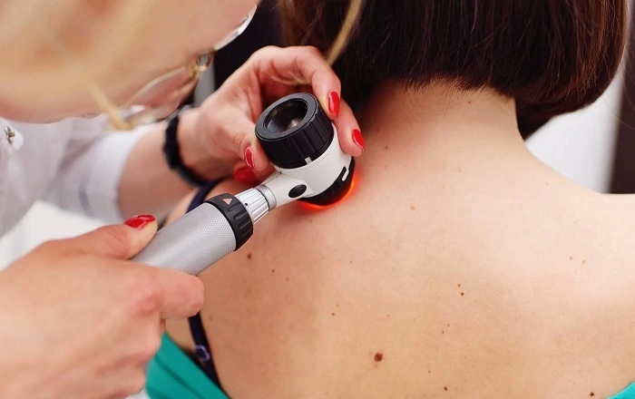 The Role of Dermatologists in Skin Cancer Prevention (1)